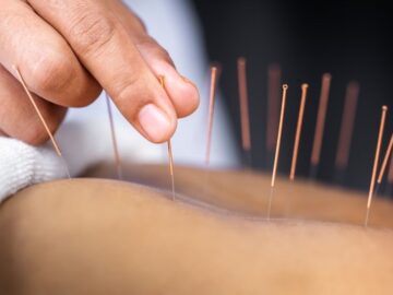 Het Parool over kostenbesparing in de zorg door alternatieve geneeswijzen als acupunctuur